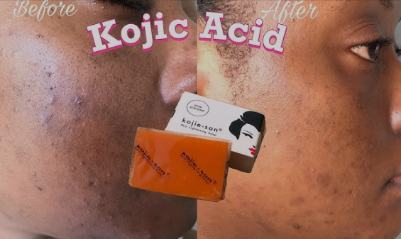 ORIGINAL Kojie San Skin Lightening Kojic Acid Soap, 135g x2 Bars