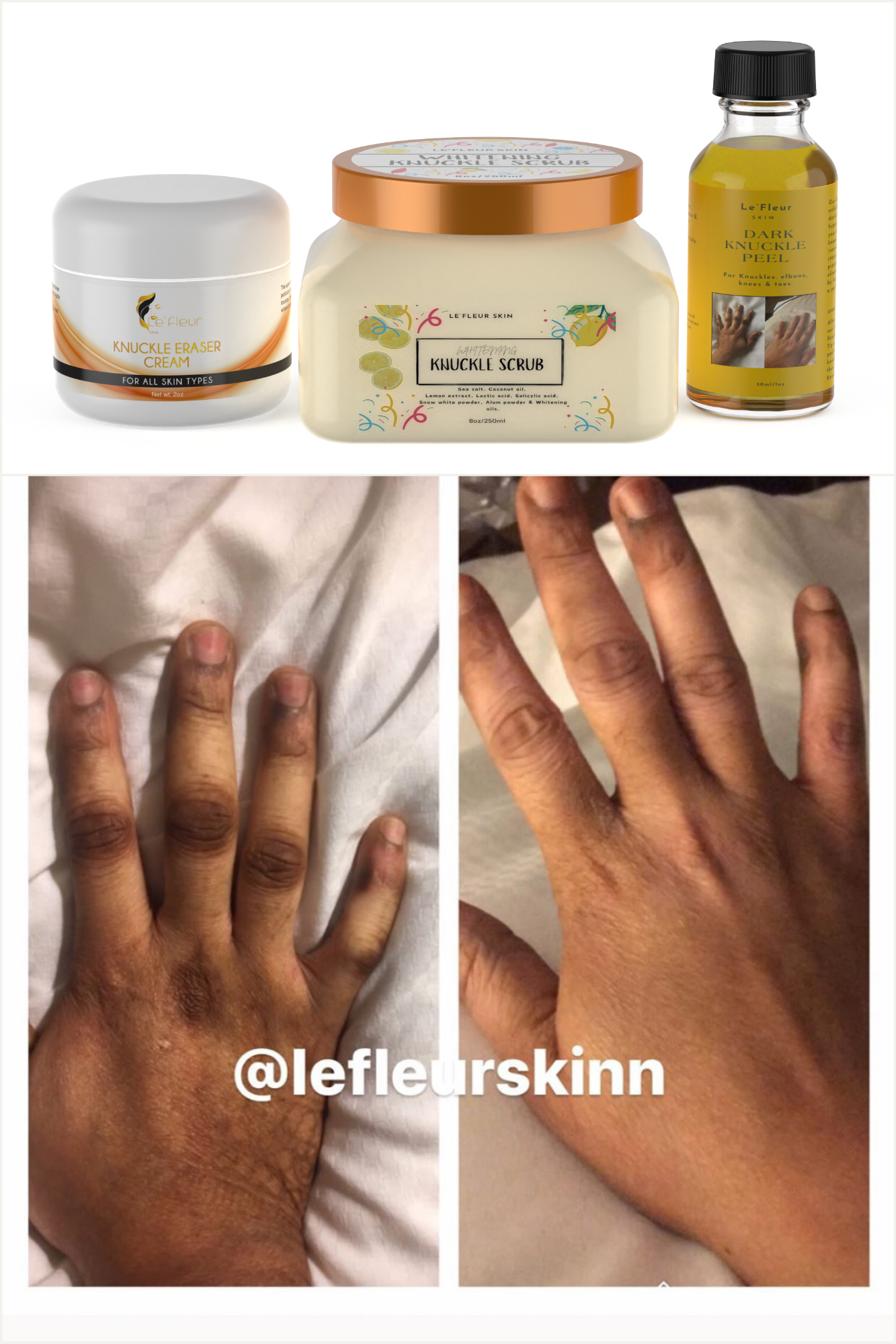 Outlet Knuckle cream